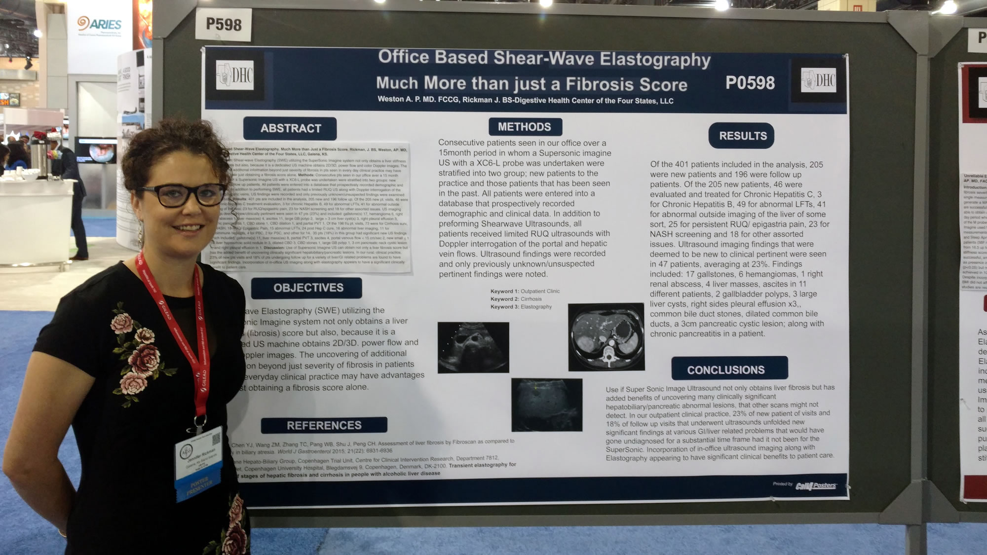 Office Based Shear-Wave Elastography, Much More than just a Fibrosis Score